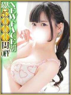 MION
