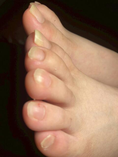 須永　もも 踏み活（足フェチ特化型風俗店）