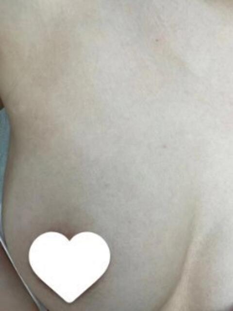 松浦こころ 全裸美女からのカゲキな誘惑（ホテヘル＆デリヘル）