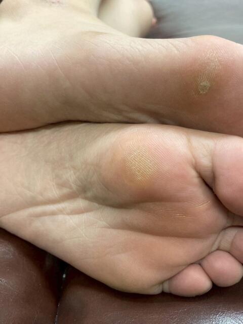 赤城　りょう 踏み活（足フェチ特化型風俗店）