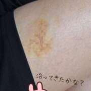 ヒメ日記 2025/07/10 12:09 投稿 乙葉もも 彩タマンサ（埼玉ハレ系）