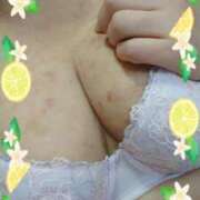 ヒメ日記 2025/07/06 11:15 投稿 リャオ 西川口デッドボール