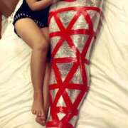 ヒメ日記 2025/03/19 16:32 投稿 恵里ザベス ビザールクリニック