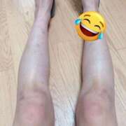 ヒメ日記 2025/11/11 14:41 投稿 チュパカブラ ビザールクリニック