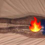 ヒメ日記 2025/03/26 12:55 投稿 蛇苺 ビザールクリニック