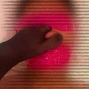 ヒメ日記 2025/03/27 12:00 投稿 蛇苺 ビザールクリニック