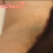 ヒメ日記 2025/04/20 17:29 投稿 蛇苺 ビザールクリニック