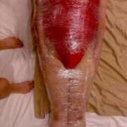 ヒメ日記 2025/08/09 13:52 投稿 蛇苺 ビザールクリニック