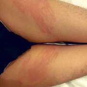 ヒメ日記 2024/12/20 23:26 投稿 小俣かおる ビザールクリニック