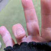 ヒメ日記 2025/08/03 08:59 投稿 あられ 妻天 日本橋店