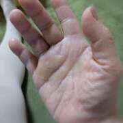 ヒメ日記 2025/08/11 13:25 投稿 あられ 妻天 日本橋店