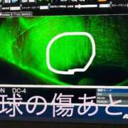 八代麻里江 【お詫びとお知らせ】眼球に傷が ローテンブルク