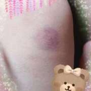 ヒメ日記 2025/05/21 10:19 投稿 入江 鶯谷デッドボール