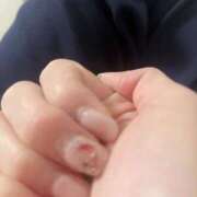 ヒメ日記 2025/07/30 11:48 投稿 ひまり 若葉