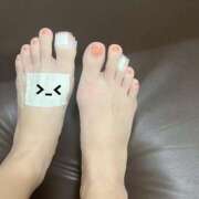 ヒメ日記 2025/08/15 21:19 投稿 りんご 札幌しこたまクリニック