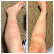 ヒメ日記 2025/07/14 03:26 投稿 るい 西船人妻花壇