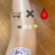 ヒメ日記 2025/08/20 18:03 投稿 リノ アラカルト