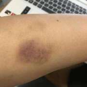 ヒメ日記 2025/03/31 16:51 投稿 みずき 愛知弥富ちゃんこ