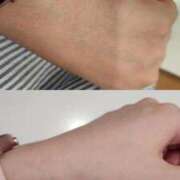 ヒメ日記 2025/07/18 18:21 投稿 ゆな 千葉松戸ちゃんこ