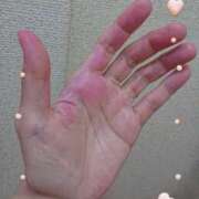 ヒメ日記 2025/01/17 14:06 投稿 琴美（ことみ） 激やみ！痴女伝説　鶯谷店