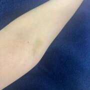 ヒメ日記 2025/04/28 13:13 投稿 まり 横浜しこたまクリニック