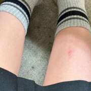 りん ピリピリする🥹 東京リップ 立川店