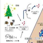 LiSA あれるぎー。 LEVEL1