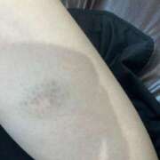 ヒメ日記 2025/06/09 13:50 投稿 まいん 京都出張メンズエステChou Chou（シュシュ)