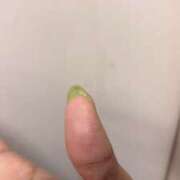 ヒメ日記 2025/08/25 12:04 投稿 マンミカ ビザールクリニック