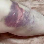 ヒメ日記 2025/03/07 11:20 投稿 夏海 福盛