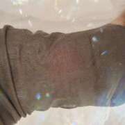 ヒメ日記 2025/05/08 18:36 投稿 秋田女医 病院