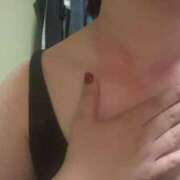 岡野ひろこ 金属アレルギー MADAM