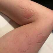 ヒメ日記 2025/12/20 14:56 投稿 Yura 上野M性感フェチ倶楽部 インサニティ東京