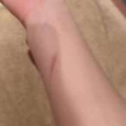 ♡チフネ やけどしてました MEGA PALACE(メガパレス）