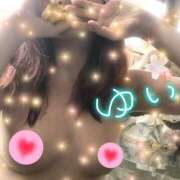 ヒメ日記 2025/08/09 12:03 投稿 ゆい ファーストレディ(博多)