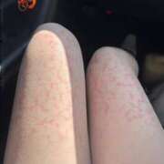 ヒメ日記 2025/07/28 17:59 投稿 えび DOLCE