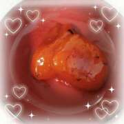 ヒメ日記 2025/07/09 22:01 投稿 もなみ 全裸SUPERプレミアム