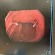 黒木陽七乃 これこれ 五十路マダム 郡山店