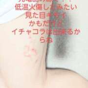 ヒメ日記 2025/07/18 21:26 投稿 まこ 新潟市鳥屋野潟ちゃんこ