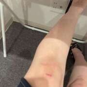 ヒメ日記 2025/07/30 08:25 投稿 あずき 極楽城(ゴクラクジョウ)