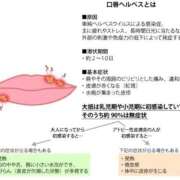 あさひ♪ 口唇ヘルペス プリティーガール
