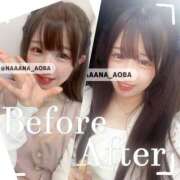 ヒメ日記 2025/04/18 11:28 投稿 なな あおば睾丸診療所