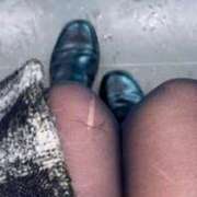 ヒメ日記 2025/03/05 09:28 投稿 しゅう あおば睾丸診療所