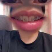 ヒメ日記 2025/07/09 08:59 投稿 蘭 [ラン] ゆるふわ彼女