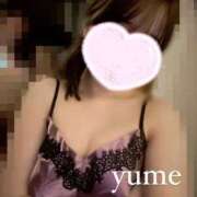 ユメ 久しぶりに On a best（オンナベスト）