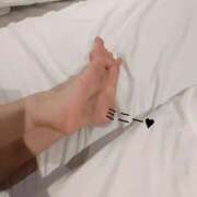 ヒメ日記 2025/07/03 13:36 投稿 三二一（ミニー） ビザールクリニック