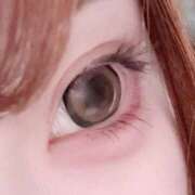 夢（ゆめ） 片目だしてみた無加工 NOA（ノア）