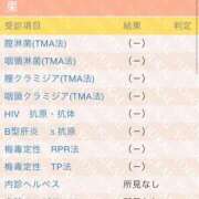 ヒメ日記 2026/05/14 20:21 投稿 あお エンジェルマスカット