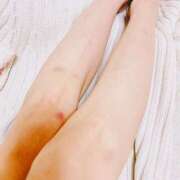 ヒメ日記 2025/03/18 11:57 投稿 しずか モアグループ南越谷人妻花壇