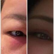 ヒメ日記 2025/04/25 09:11 投稿 飛鳥さん SA～Sanitatem Angelum～癒やしの天使